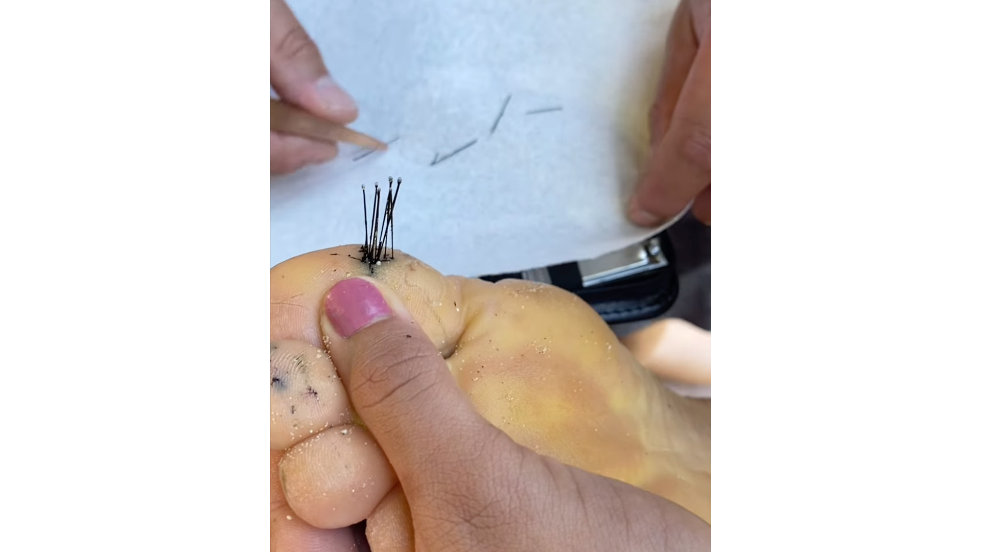 Hawai‘i Scene on Social: Stepped on