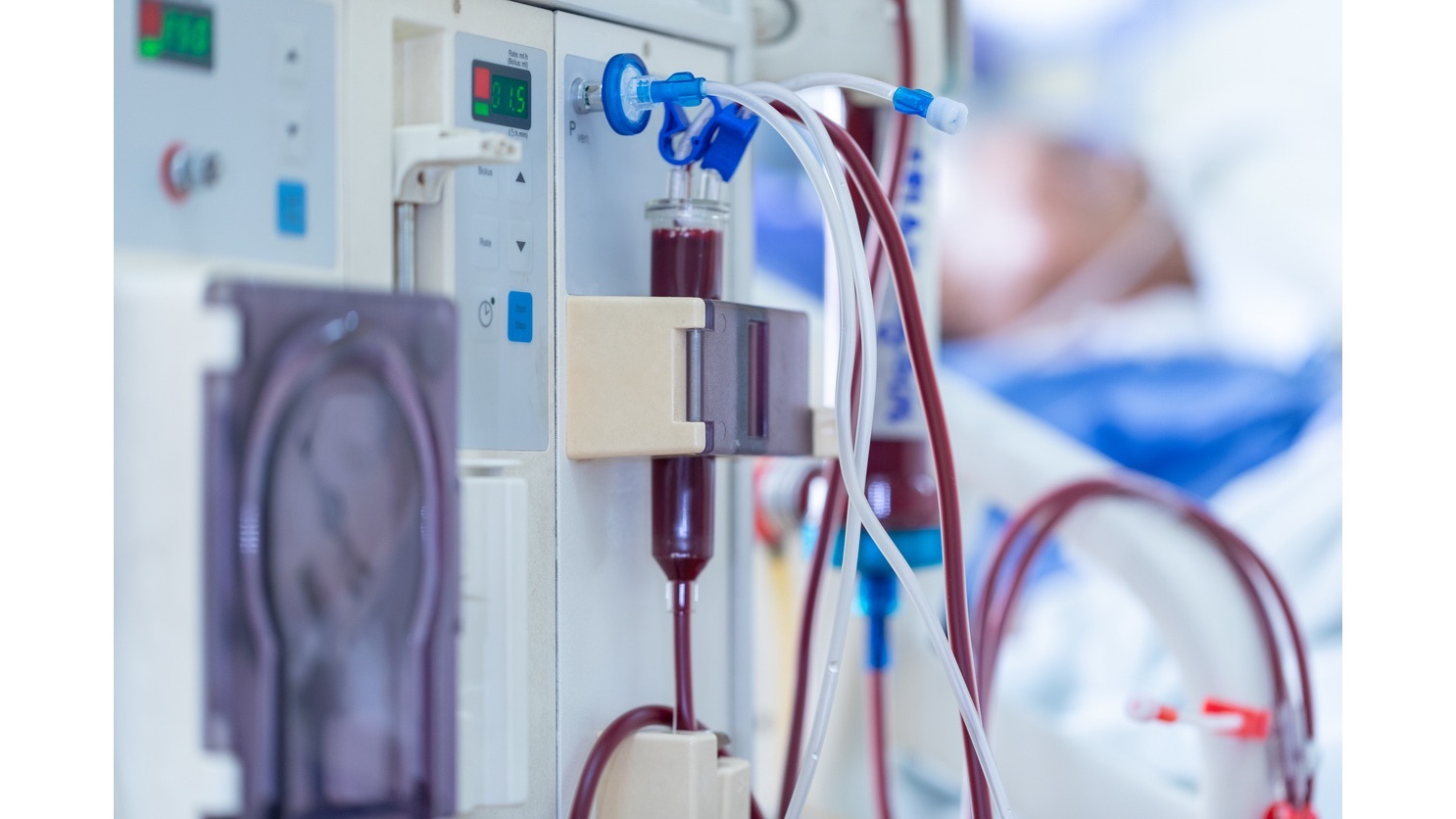 dialysis machine